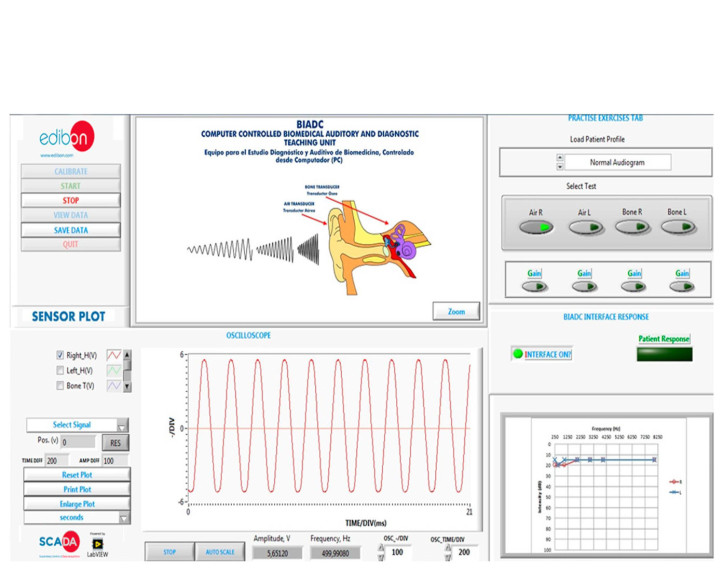 COMPUTER CONTROLLED BIOMEDICAL DIAGNOSIS AND AUDITORY UNIT - BIADC